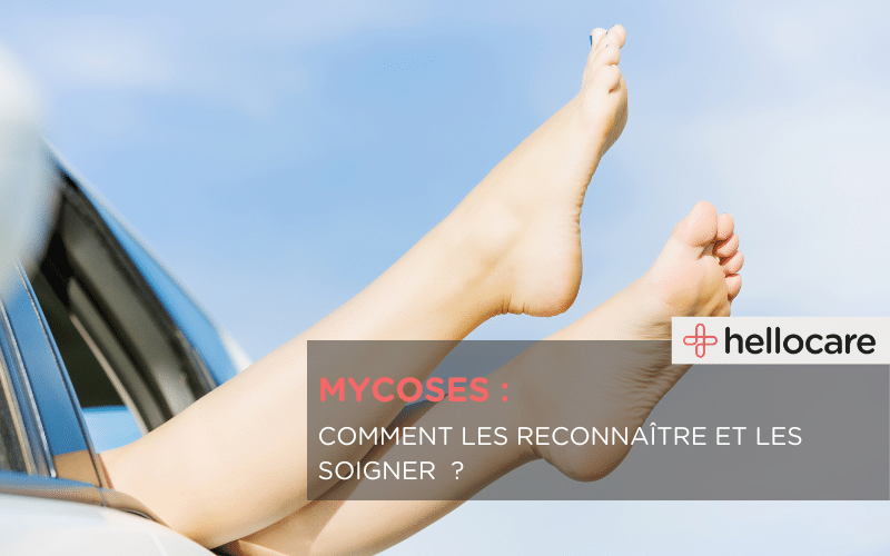 mycose : reconnaitre et soigner les mycoses