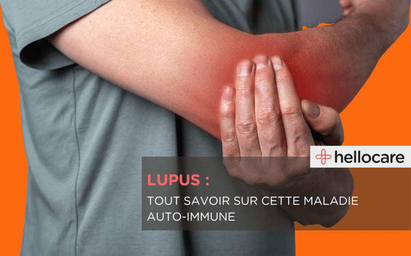Lupus : causes, symptômes et traitements